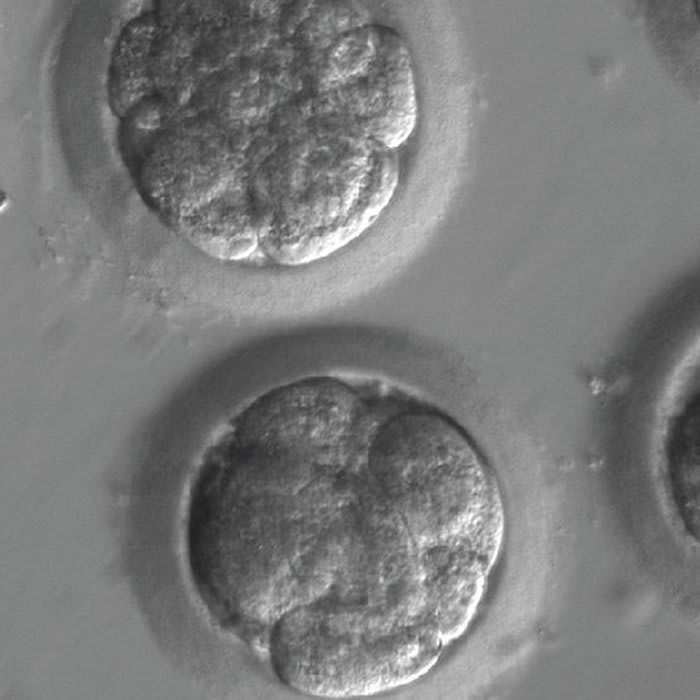 In Breakthrough, Scientists Edit a Dangerous Mutation From Genes in Human Embryos