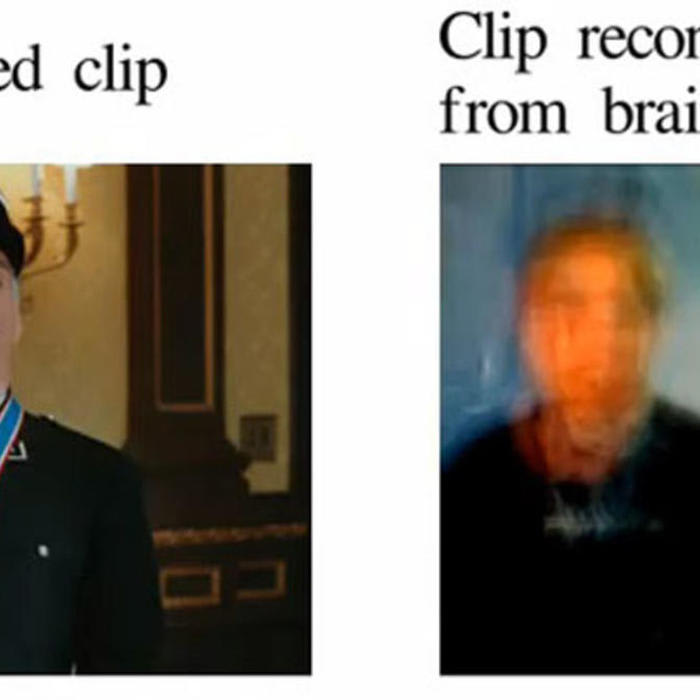Brain Scanner Records Dreams on Video