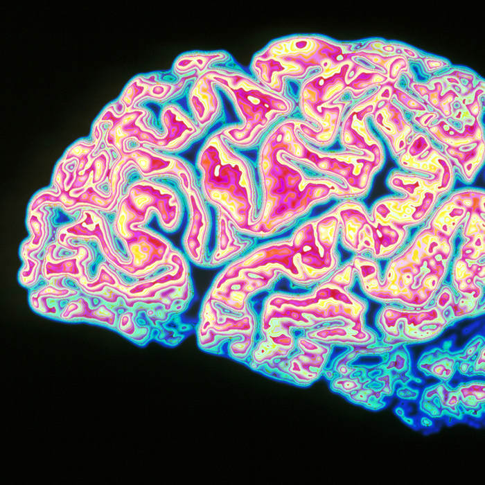 Brain's Link To Immune System Might Help Explain Alzheimer's