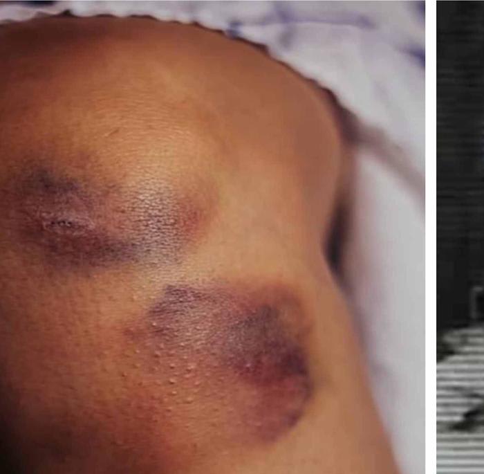 A Girl Wakes Up With Bruises on her body And The Reason is Shocking!!