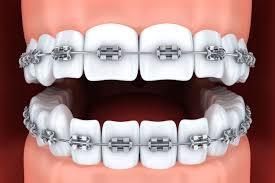 Pertimbangan Kunci untuk Menemukan Klinik Gigi yang Sempurna