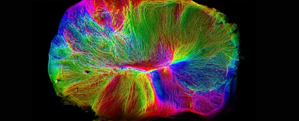 Scientists Grew a Mini-Brain in a Dish, And It Extended Freaky Tendrils to Reach a Spinal Cord