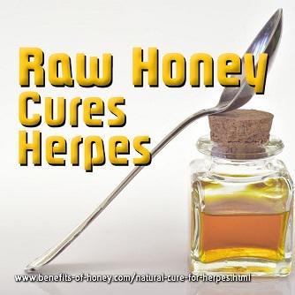 Natural Cure for Herpes Symptoms: Honey