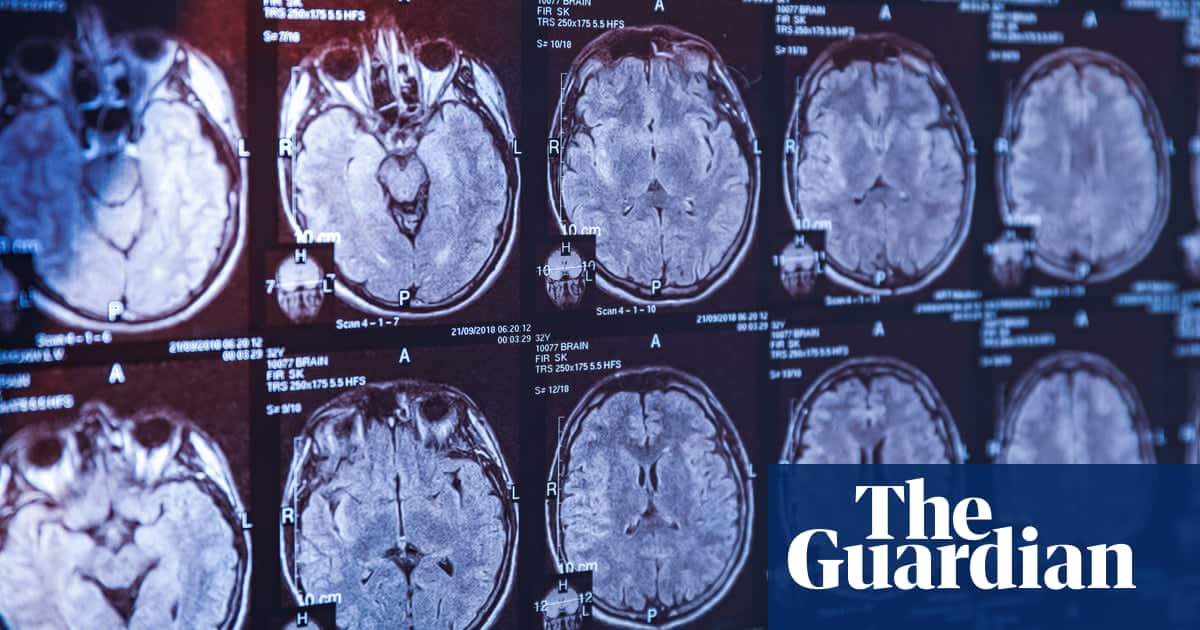 Scientists discover why humans have such big brains