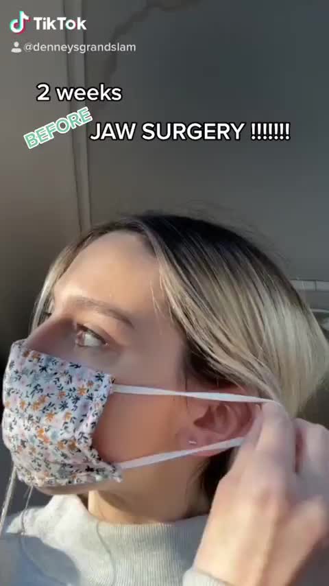The difference that a jaw surgery does!