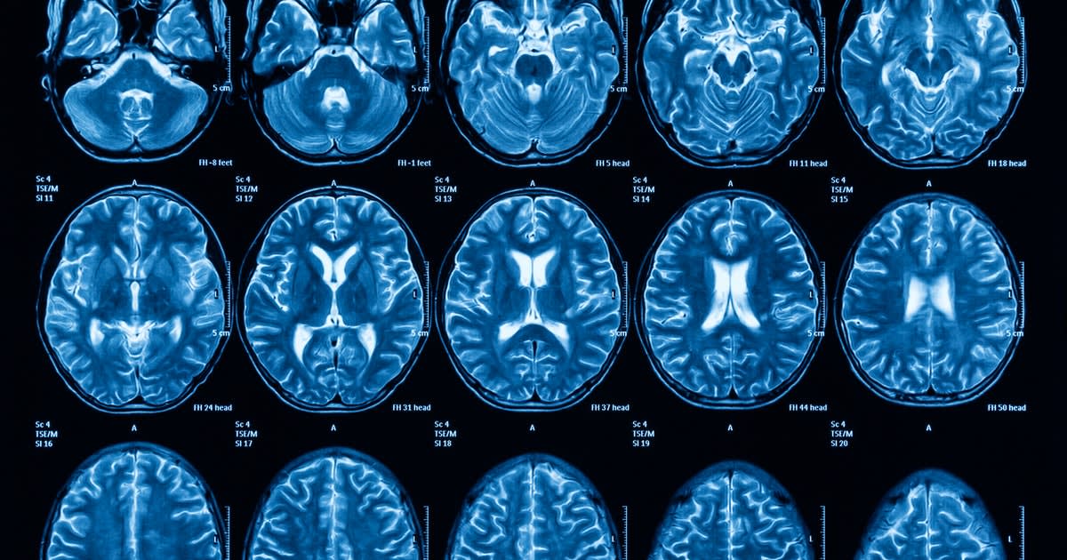 Blindsight: Can a strange neurological condition explain consciousness?