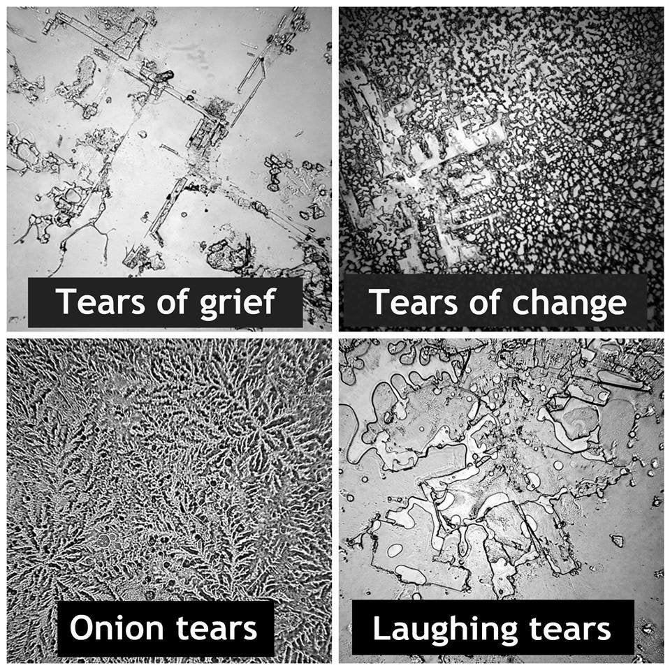 Different Types of Tears