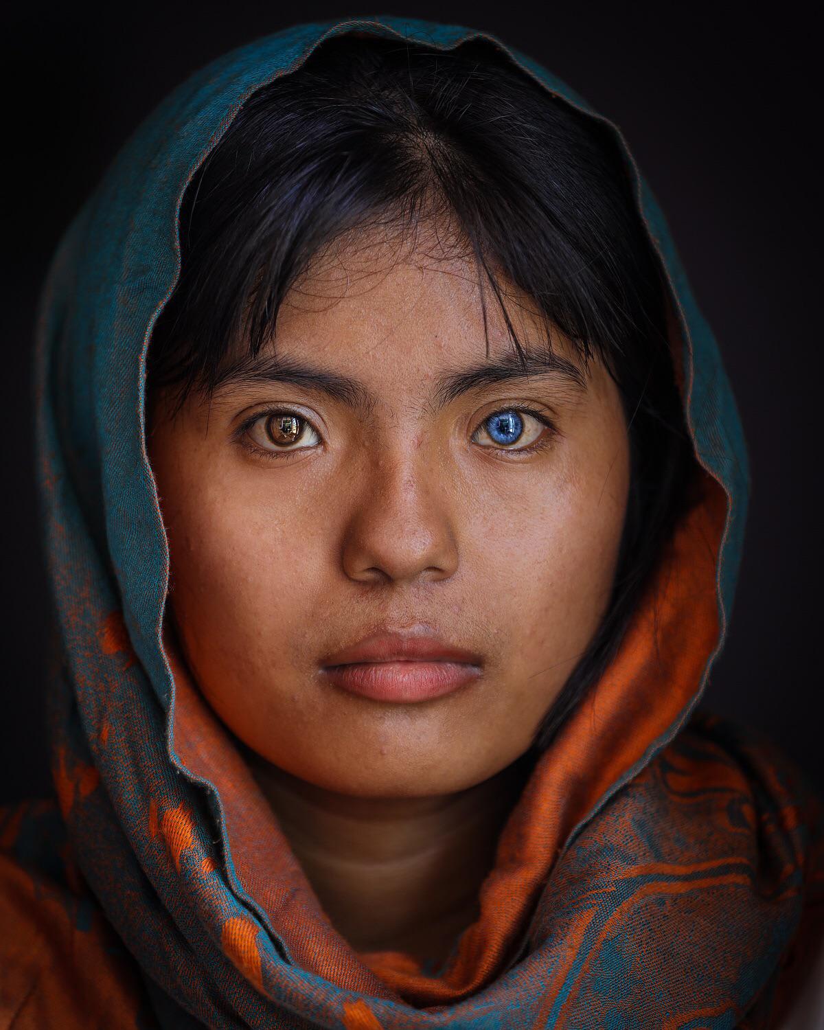 Thạch Thị Sa Pa is a young Chams woman with heterochromia iridis—one eye is blue and the other brown, Vietnam (photographed by Trần Tuấn Việt)