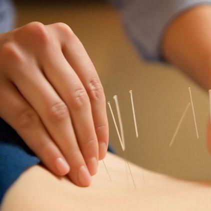 5 Top Tips for Selecting an Acupuncturist - Hardik Thomas - Medium
