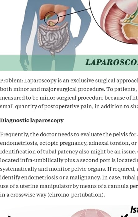 laparoscopy: a new boon in the gynecology field