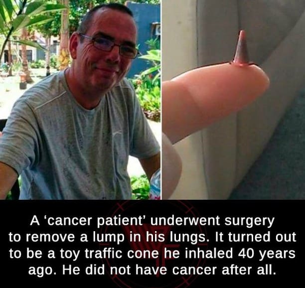 This "Cancer Patient"