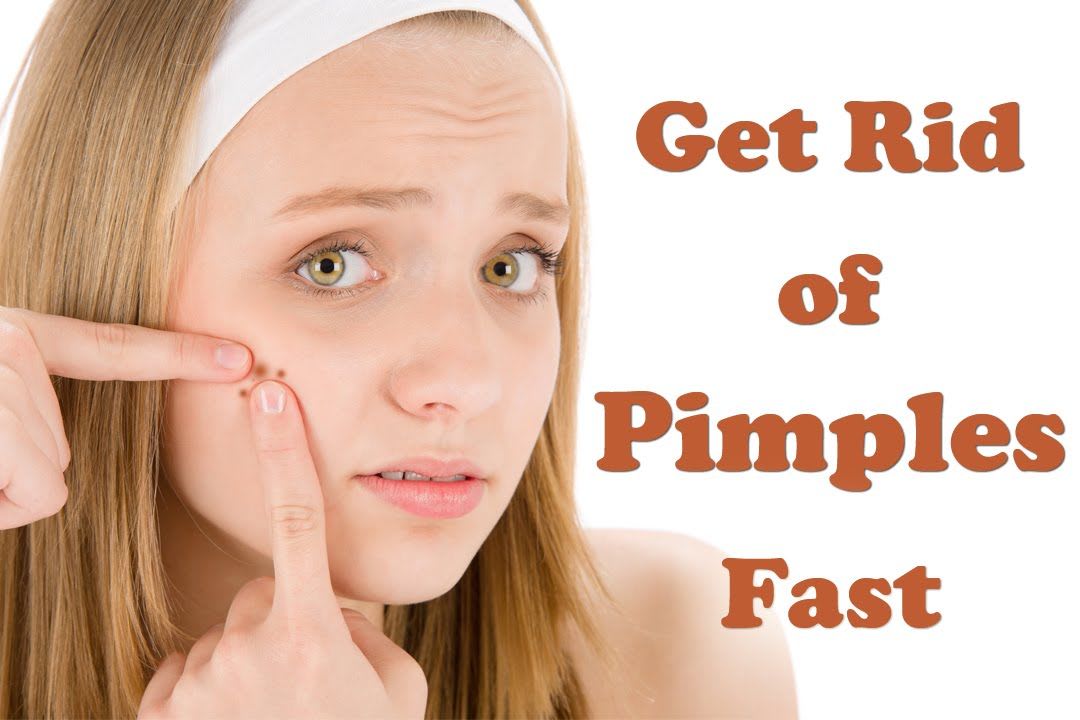 How To Get Rid of Pimples