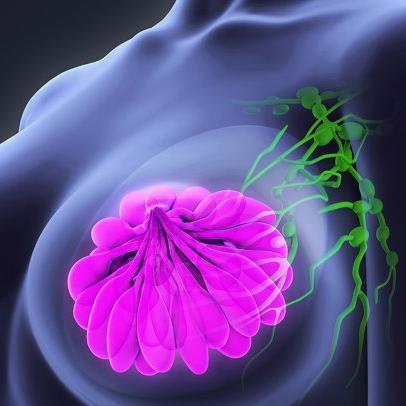 3 die of breast cancer after receiving organs from same donor: report