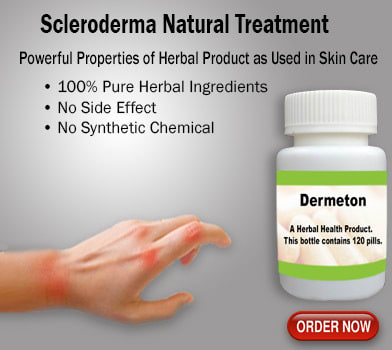 Home Remedies for Scleroderma with Healthy Foods & Lifestyle Changes