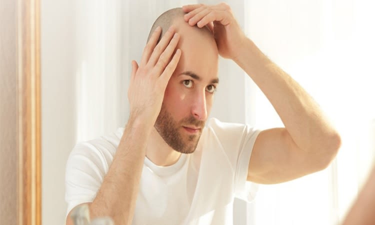How New-age Hair Transplants Help Regain Young Days