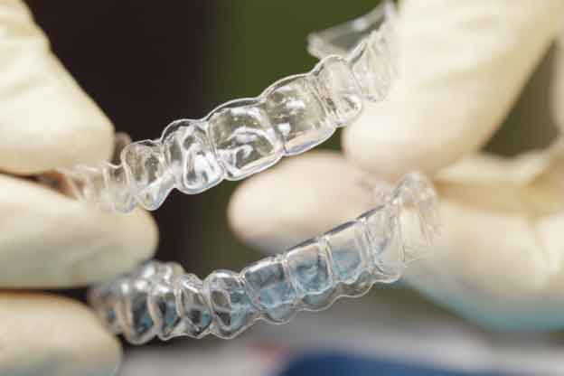 How Well Does Invisalign Actually Work? | Nordel Crossing Dental Centre