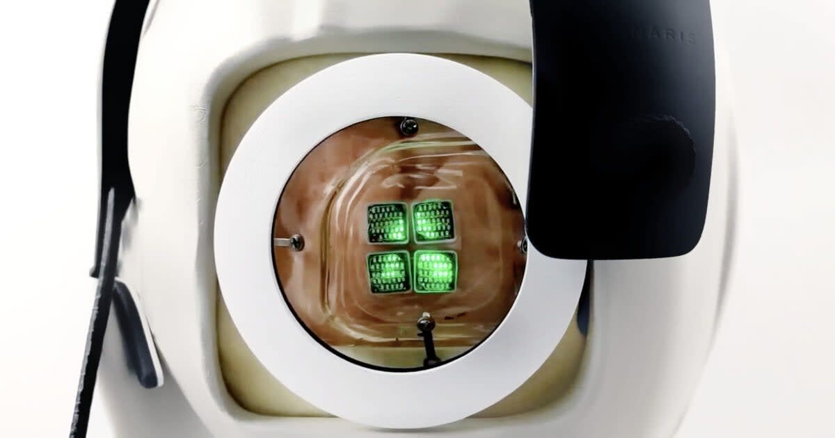 Doctors are preparing to implant the world's first human bionic eye