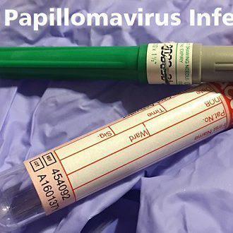 HPV (Human Papilloma Virus): Symptoms and Treatment