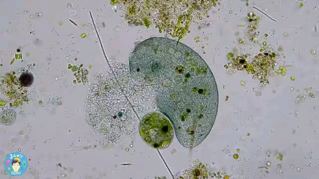 This single cell organism is astentor coeruleus and it's exploded, spilling out its cytoplasm (cell liquid) after being bitten by another single-celled organism.