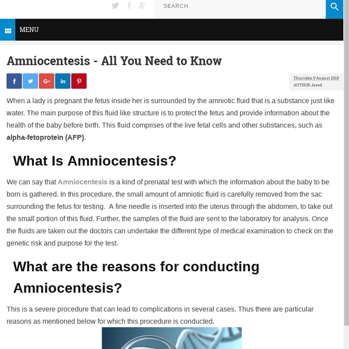 Amniocentesis - All You Need to Know