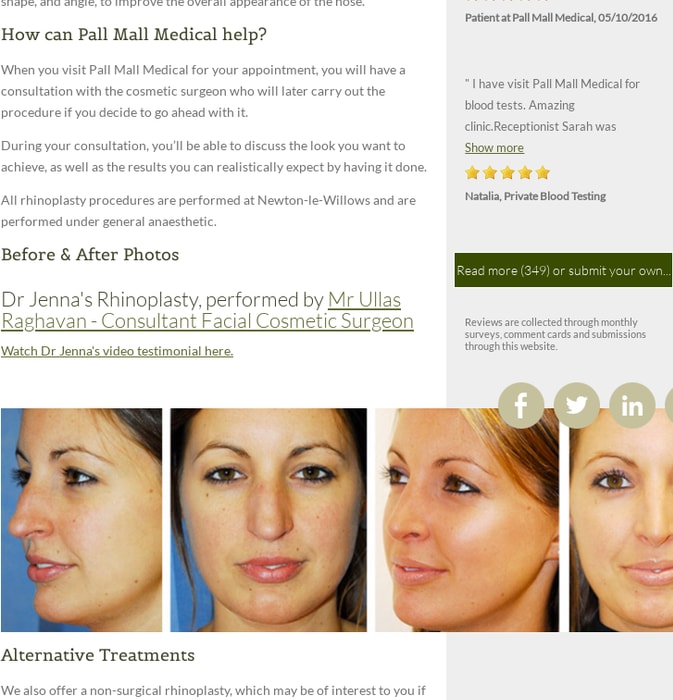 Private Nose Surgery rhinoplasty Liverpool & Manchester