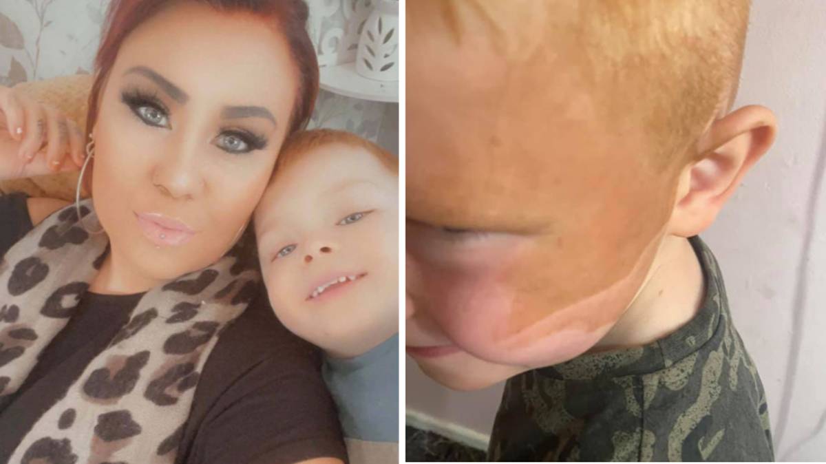 Mum Left In Stitches After Fake Tanning Son In Freak Accident