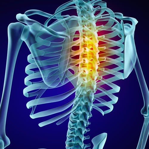 Chiropractic Biophysics - The Hidden Passage to A Pain-free Future