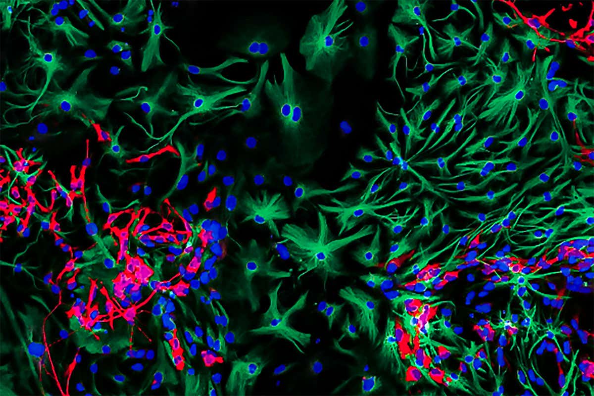 Close-up image of brain cancer cells wins photography prize