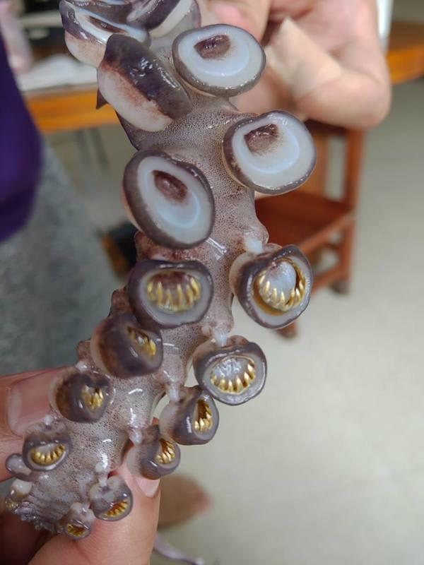Teeth in a squid suction cup.
