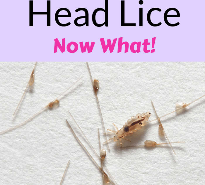 Head Lice Ultimate All Natural Treatment Oil: That Works! - Spirit of the Soul Lifestyle