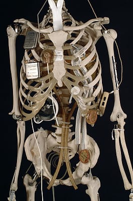 YORICK, The Bionic Skeleton