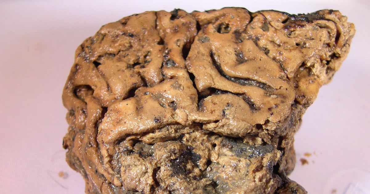 The mystery of this ancient brain, preserved for 2,600 years, may have finally been solved