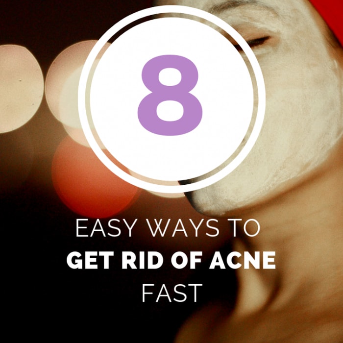 8 Easy WAYS to get rid of Acne