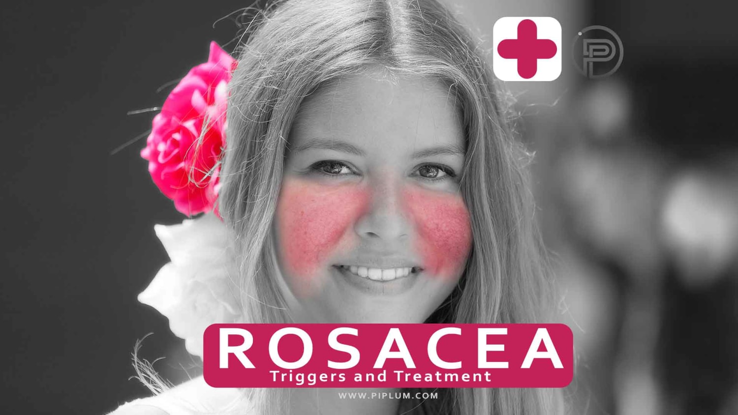 What Are The Symptoms Of Rosacea? What Are The Triggers And Risk Factors.