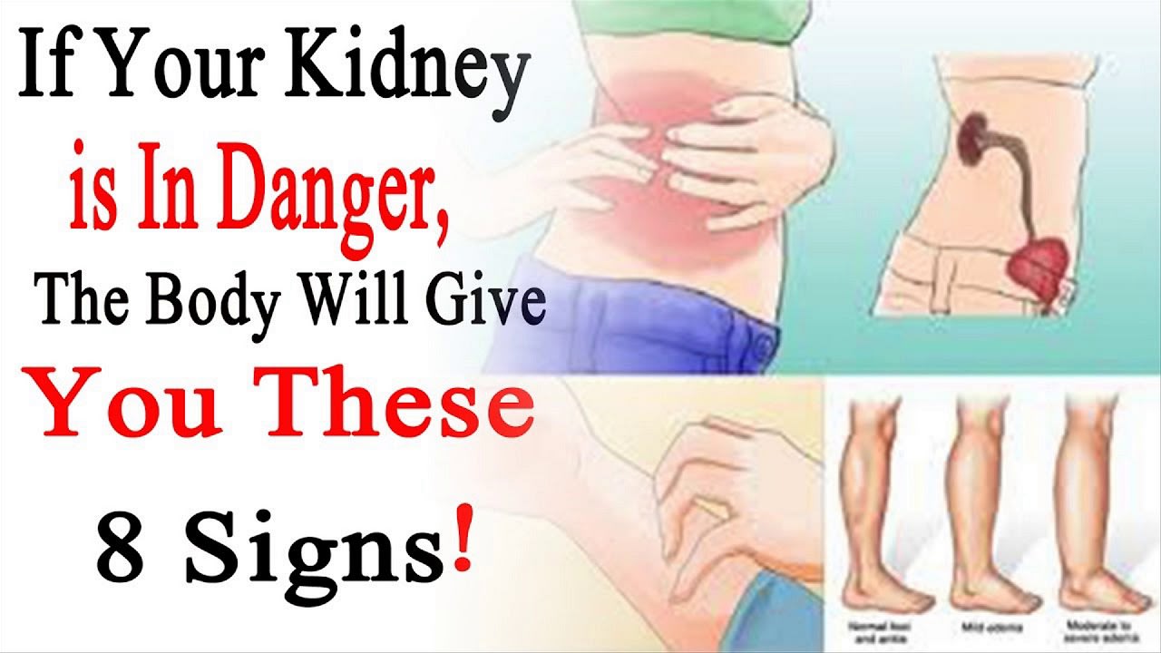 What is Kidney Failure Symptoms...?