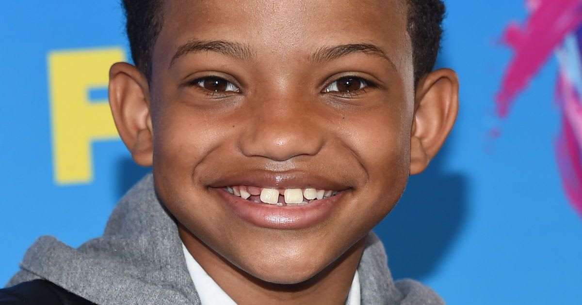 After Being Told To Fix His Teeth, 'This Is Us' Star Tells Bullies To 'Fix Your Heart'