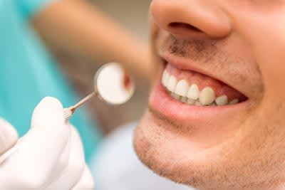 Hygiene Treatments - The Caringbah Dentists