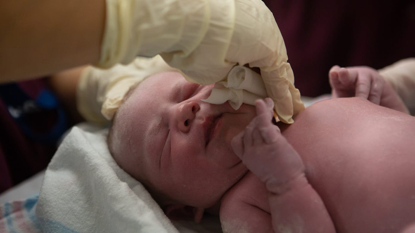 Doctors Test Bacterial Smear After Cesarean Sections To Bolster Babies' Microbiomes