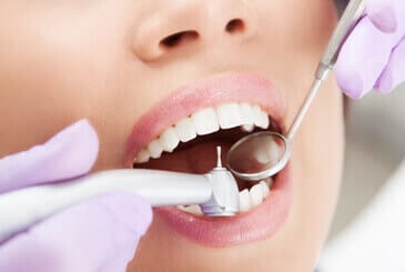 What Happens During a Teeth Cleaning? | Nordel Crossing Dental Centre