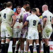 English rugby's head of medicine has indicated the game is set to face 'significant changes' due to alarming injury rise