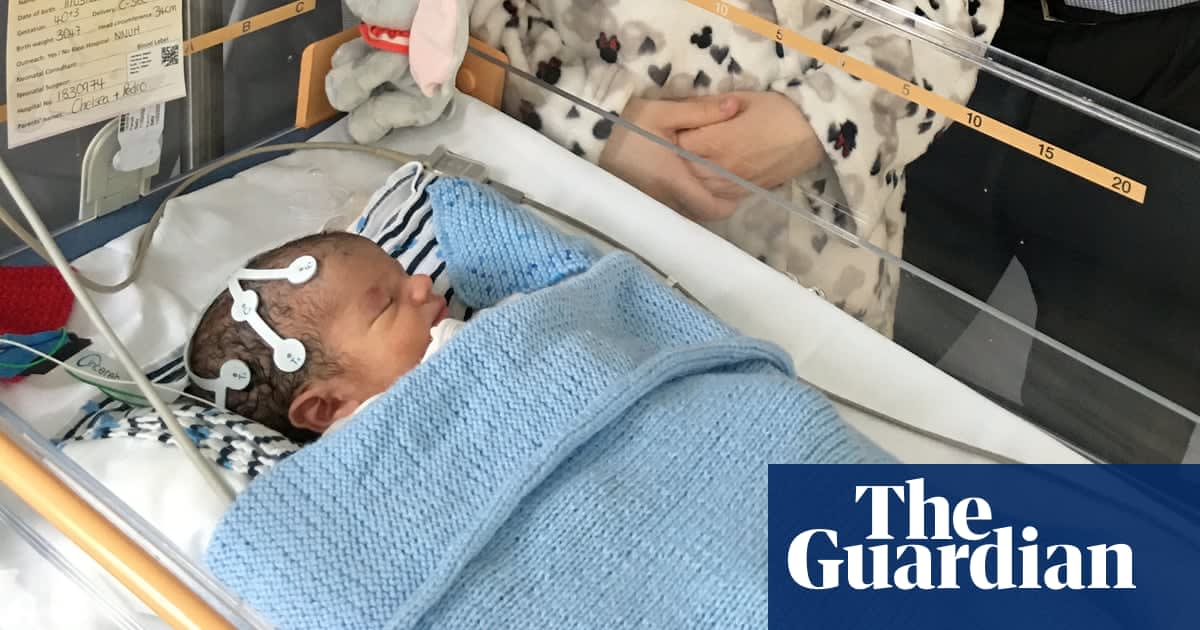 British newborn first baby in world to join cannabis therapy trial