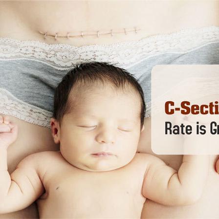 Why Cesarean Section Delivery Rate is Growing in India