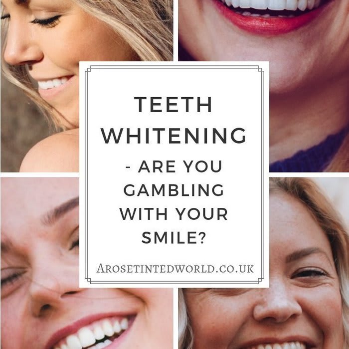 Teeth Whitening - Are You Gambling With Your Smile? ⋆ A Rose Tinted World