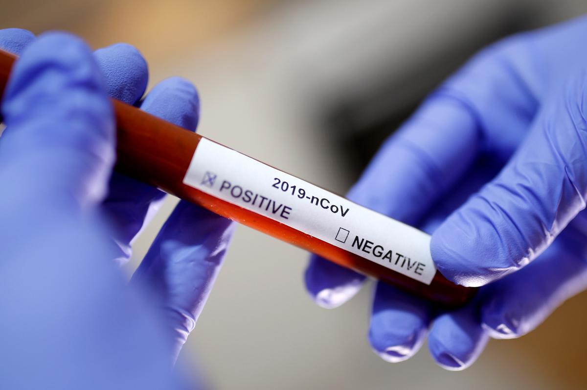 Laboratories meet with White House, form consortium for coronavirus tests