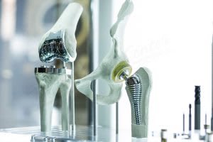 What is Total Joint Replacement Surgery?