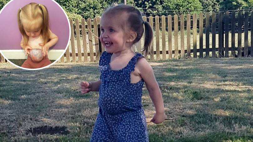 Toddler Was Born With Her Stomach, Liver And Bowel Outside Her Body