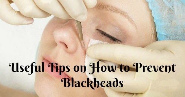 Useful Tips on How to Prevent Blackheads