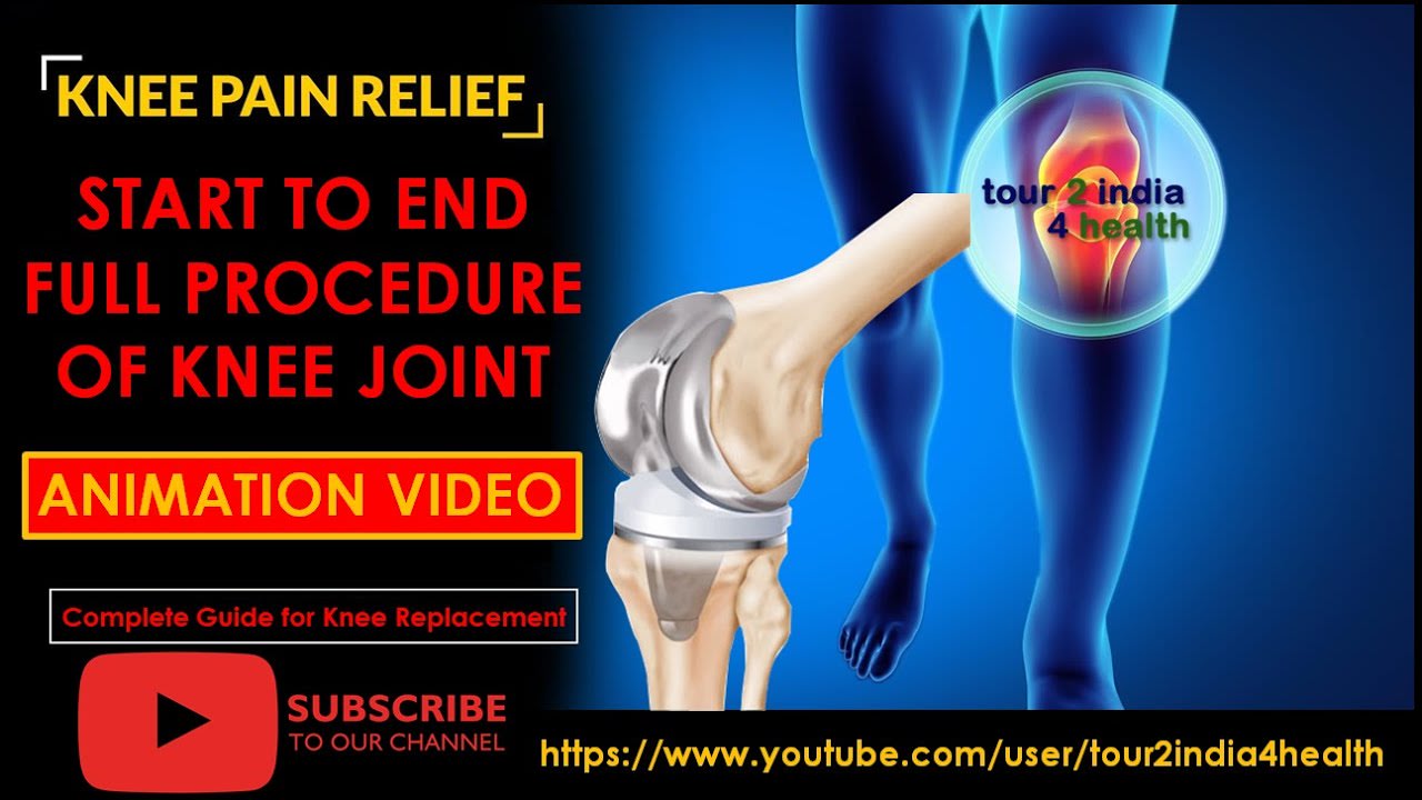 Knee Replacement Surgery in India | Start To End Full Procedure | Animation Video
