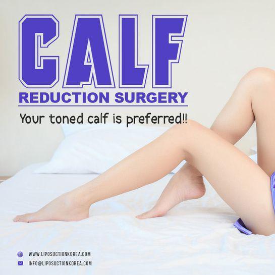 Wearing shorts is not your dream now because #liposuction_Korea offers #Calf_Reduction_Surgery that will remove the unnecessa… | Calf Reduction Surgery | Pinterest | Surgery, Liposuction and Calves