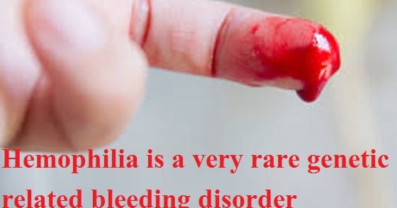 what is haemophilia: 10 signs and how to deal with it